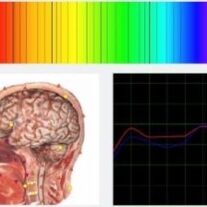 BioResonance Biofeedback